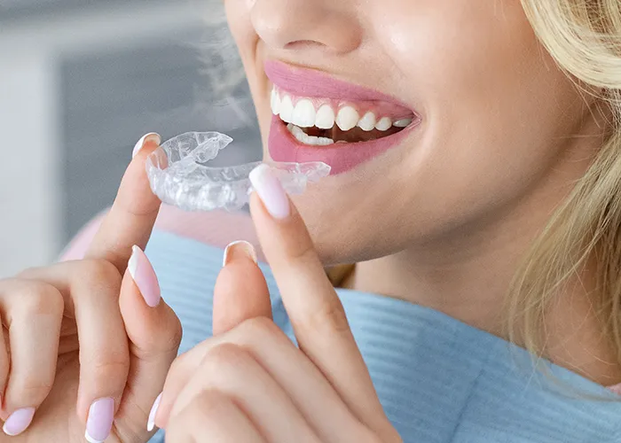 Frau setzt Invisalign-Aligner ein